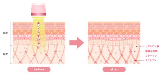 繊維芽細胞の図