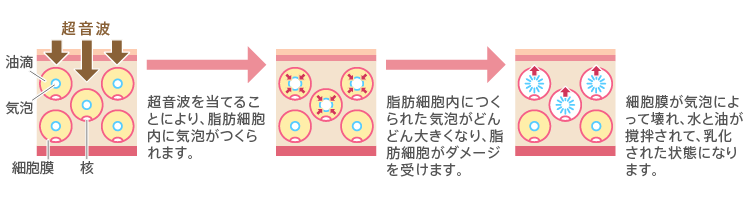 キャビテーションのメカニズム