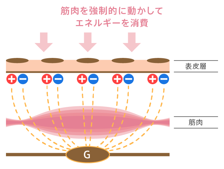 EMSのメカニズム