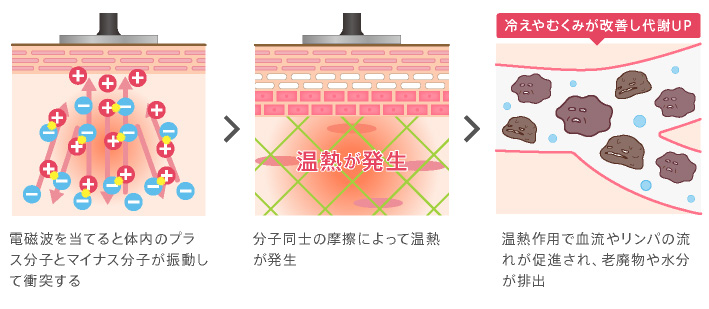 ラジオ波のメカニズム