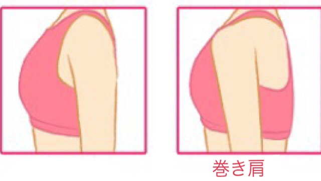 通常の肩と巻き肩の比較