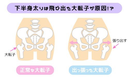 大転子の出っ張り