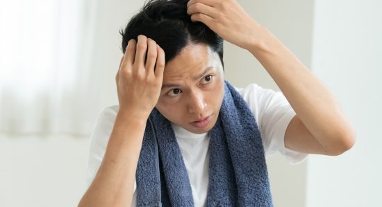 頭皮を気にする男性