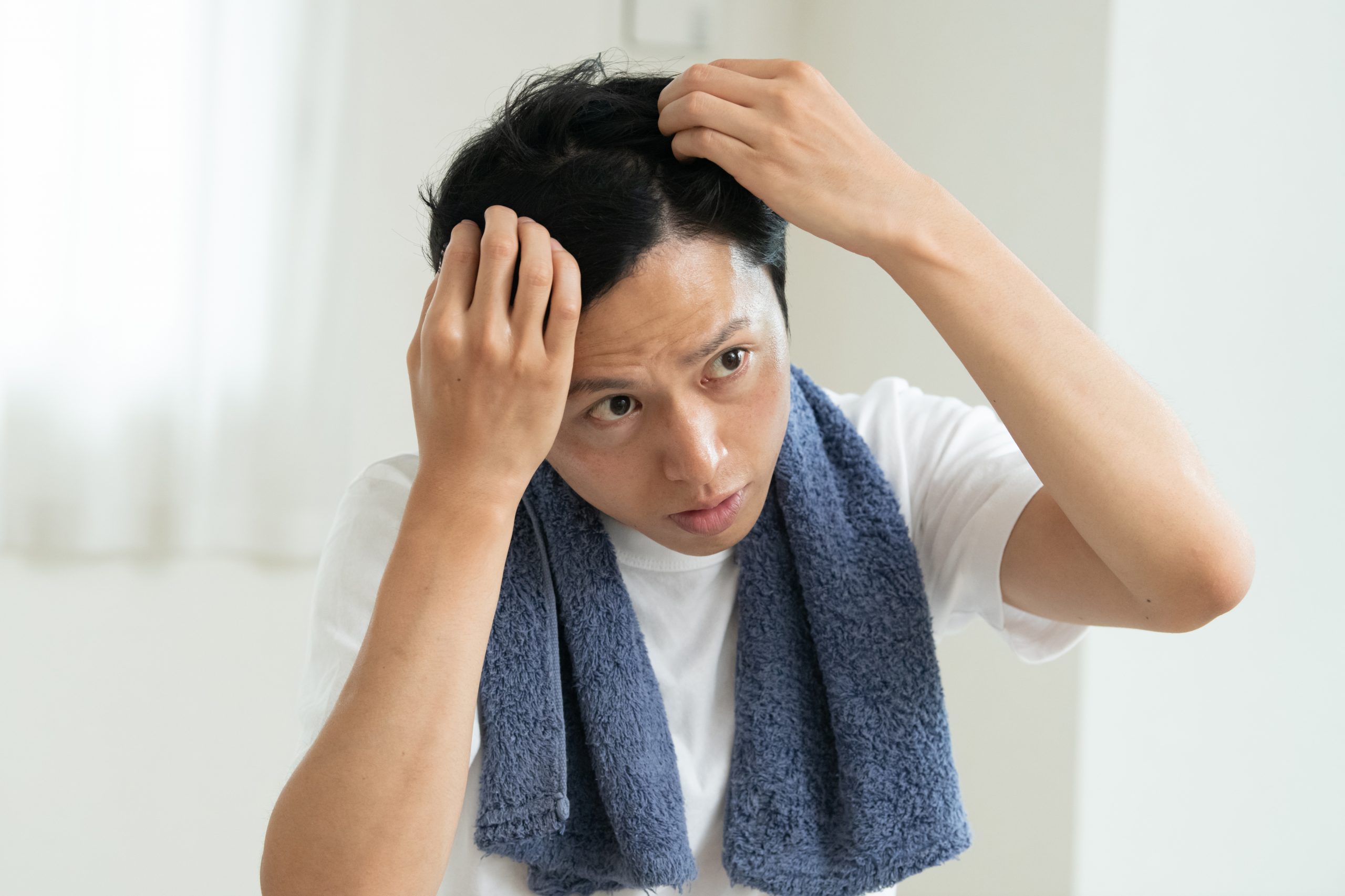 頭皮を気にする男性
